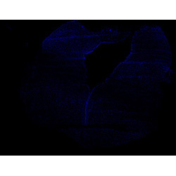 11PCW human midbrain